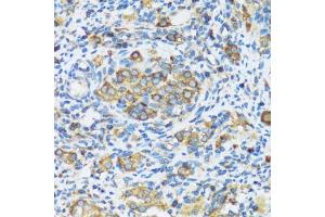 Immunohistochemistry of paraffin-embedded rat ovary using F antibody (ABIN3016158, ABIN3016159, ABIN3016160 and ABIN6219586) at dilution of 1:100 (40x lens). (APOBEC3F antibody  (AA 1-65))