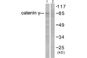 Western Blotting (WB) image for anti-Junction Plakoglobin (JUP) (C-Term) antibody (ABIN1848449) (JUP antibody  (C-Term))