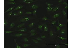 Immunofluorescence (IF) image for anti-Golgin A5 (GOLGA5) (AA 1-731) antibody (ABIN523333)