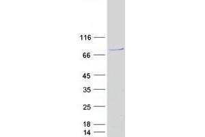 Validation with Western Blot