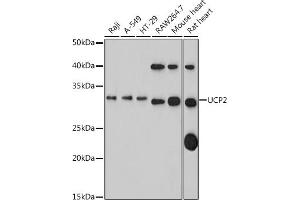 Western blot analysis of extracts of various cell lines, using UCP2 antibody (ABIN1683207, ABIN3018658, ABIN3018659 and ABIN5664678) at 1:1000 dilution. (UCP2 antibody)