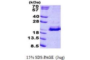 SDS-PAGE (SDS) image for Signal Recognition Particle 19kDa (SRP19) (AA 1-144) protein (His tag) (ABIN5852991) (SRP19 Protein (AA 1-144) (His tag))