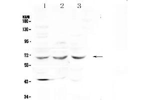 Western blot analysis of SPHK2 using anti-SPHK2 antibody .
