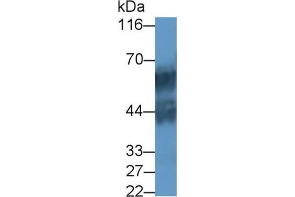 Keratin 71 antibody  (AA 132-440)