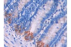 Immunohistochemistry (IHC) image for anti-Lysosomal-Associated Membrane Protein 2 (LAMP2) (AA 191-362) antibody (ABIN7437248)