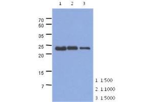 The extracts of mouse muscle (40ug) were resolved by SDS-PAGE, transferred to PVDF membrane and probed with anti-human TNNI1 antibody (1:500 ~ 1:5000). (TNNI1 antibody)
