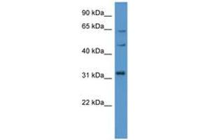 Image no. 1 for anti-MAP Kinase Interacting serine/threonine Kinase 1 (MKNK1) (C-Term) antibody (ABIN6746809) (MKNK1 antibody  (C-Term))