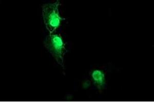 Anti-AIPL1 mouse monoclonal antibody (ABIN2455133) immunofluorescent staining of COS7 cells transiently transfected by pCMV6-ENTRY AIPL1 (RC204079). (AIPL1 antibody)