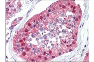 Immunohistochemistry: UBA52 antibody staining of Formalin-Fixed, Paraffin-Embedded Human Testis followed by biotinylated goat anti-rabbit IgG secondary antibody, alkaline phosphatase-streptavidin and chromogen. (UBA52 antibody  (C-Term))