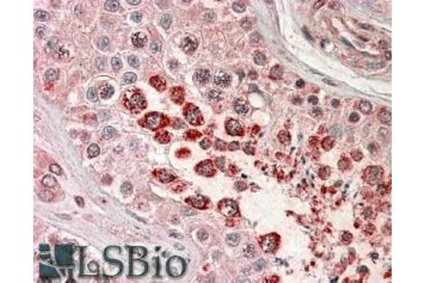 XAGE1B/GAGED2 antibody  (C-Term)