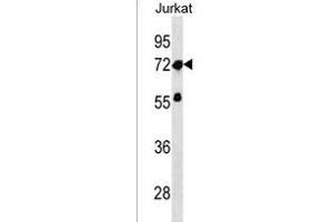 ZNF286A Antibody (Center) (ABIN1538091 and ABIN2850402) western blot analysis in Jurkat cell line lysates (35 μg/lane). (ZNF286A antibody  (AA 213-239))