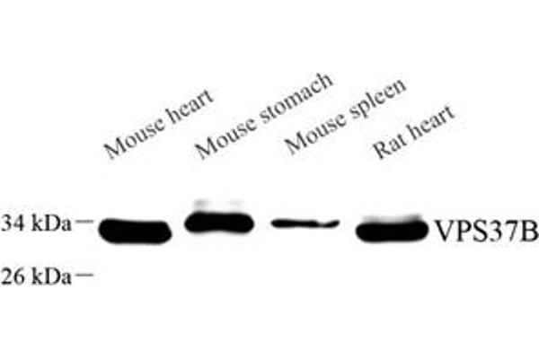VPS37B antibody