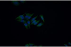 Detection of CD5 in Human HepG2 cell using Polyclonal Antibody to Cluster Of Differentiation 5 (CD5) (CD5 antibody  (AA 25-372))