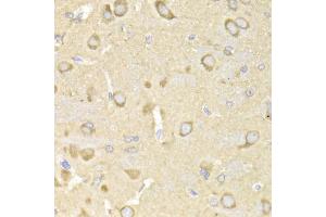 Immunohistochemistry of paraffin-embedded rat brain using TRAP1 Antibody (ABIN1875197) at dilution of 1:200 (40x lens). (TRAP1 antibody)