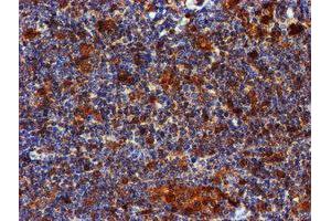 Image no. 6 for anti-LIM Domain Kinase 1 (LIMK1) antibody (ABIN1499147)