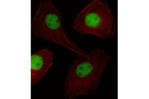 Fluorescent image of  cell stained with PGR/PR Antibody (C-term) (ABIN1537613 and ABIN2838264).