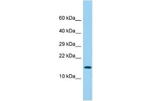 Host: Rabbit Target Name: LY6G6D Sample Type: Fetal Lung lysates Antibody Dilution: 1. (LY6G6D antibody  (N-Term))