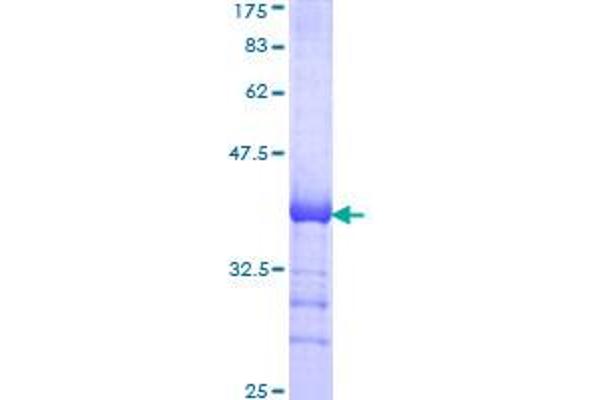 CDC42BPB Protein (AA 1580-1679) (GST tag)