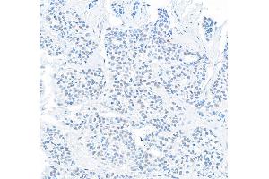 Immunohistochemistry (IHC) image for anti-Deleted in Esophageal Cancer 1 (DEC1) (C-Term) antibody (ABIN7454653)
