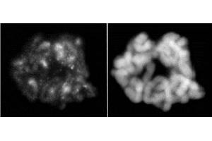 Histone H3. (Histone H3.1 antibody  (pSer28))