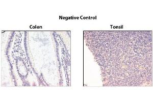Negative control. (DcR1 antibody)