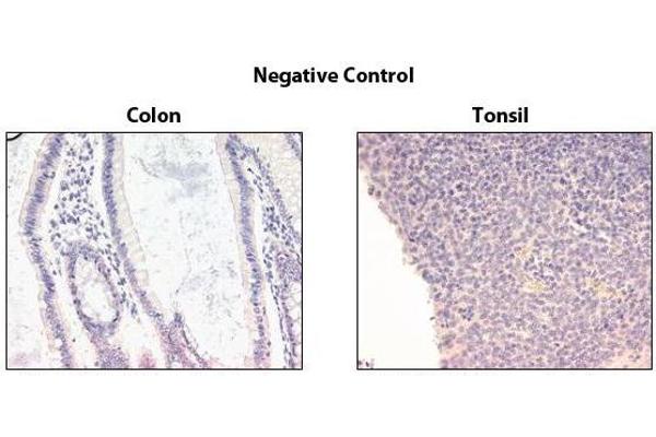 DcR1 antibody