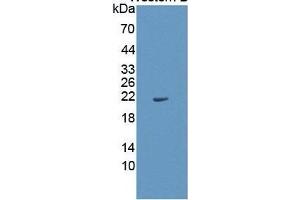 WB of Protein Standard: different control antibodies  against Highly purified E. (IL1A ELISA Kit)
