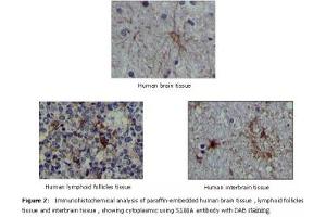 Image no. 1 for anti-S100 Calcium Binding Protein A1 (S100A1) antibody (ABIN232125) (S100A1 antibody)