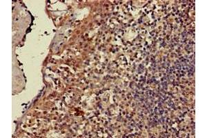Immunohistochemistry (IHC) image for anti-CD247 Molecule (CD247) (AA 88-153) antibody (ABIN7171394)