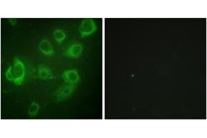 Immunofluorescence analysis of HuvEc cells, using Myosin regulatory light chain 2 (Phospho-Ser18) Antibody.