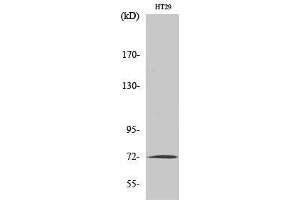 Western Blotting (WB) image for anti-Matrix Metalloproteinase 2 (MMP2) (C-Term) antibody (ABIN3176049) (MMP2 antibody  (C-Term))