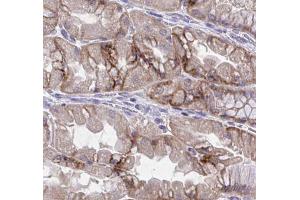 ABIN6277257 at 1/100 staining human kidney tissues  sections by IHC-P. (IL-8 antibody  (Internal Region))