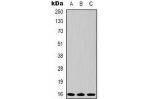 Western blot analysis of Survivin expression in Hela (A), 293 (B), PC12 (C) whole cell lysates. (Survivin antibody)
