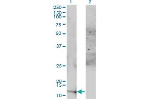 ACYP1 antibody  (AA 1-99)