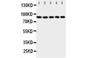 Western Blotting (WB) image for anti-Arachidonate 5-Lipoxygenase (ALOX5) (AA 650-667), (C-Term) antibody (ABIN3044238)