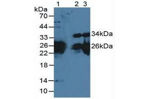Figure. (MYL3/CMLC1 antibody  (AA 8-199))