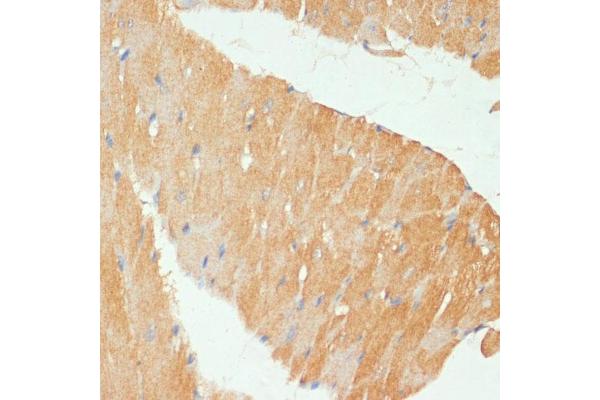 MYBPC3 antibody  (AA 200-400)