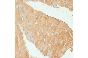 Immunohistochemistry of paraffin-embedded mouse heart using MYBPC3 antibody (ABIN6129601, ABIN6144221, ABIN6144222 and ABIN6215951) at dilution of 1:100 (40x lens). (MYBPC3 antibody  (AA 200-400))