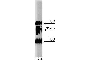 Western blot analysis of Arginase I on a mouse liver lysate. (Liver Arginase antibody  (AA 53-207))
