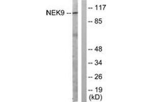 Western blot analysis of extracts from A549 cells, using NEK9 (Ab-210) Antibody. (NEK9 antibody  (AA 176-225))