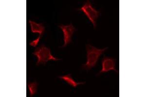 ABIN6269092 staining K562 by IF/ICC. (EIF2S1 antibody  (N-Term))