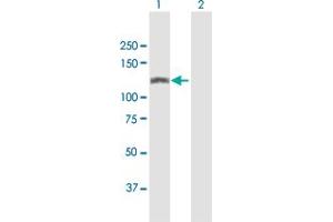 Western Blot analysis of SMARCA5 expression in transfected 293T cell line by SMARCA5 MaxPab polyclonal antibody. (SMARCA5 antibody  (AA 1-1052))