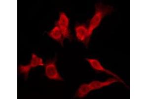 ABIN6276157 staining Hela by IF/ICC. (OR4K3 antibody)