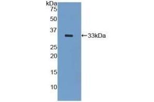 Detection of Recombinant KRT5, Mouse using Polyclonal Antibody to Cytokeratin 5 (CK5) (Cytokeratin 5 antibody  (AA 163-471))
