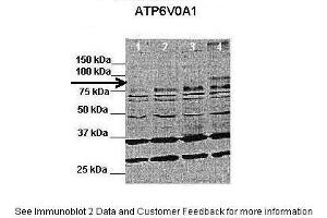 Western Blotting (WB) image for anti-ATPase, H+ Transporting, Lysosomal V0 Subunit A1 (ATP6V0A1) (C-Term) antibody (ABIN2780008) (ATP6V0A1 antibody  (C-Term))