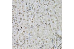 Immunohistochemistry (Paraffin-embedded Sections) (IHC (p)) image for anti-Mitogen-Activated Protein Kinase 3 (MAPK3) (AA 1-100) antibody (ABIN3020725)