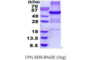 Image no. 1 for PHD Finger Protein 11 (PHF11) protein (His tag) (ABIN1098697) (PHF11 Protein (His tag))
