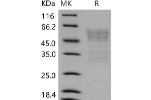 Western Blotting (WB) image for Syndecan 1 (SDC1) protein (His tag) (ABIN7320206) (Syndecan 1 Protein (SDC1) (His tag))
