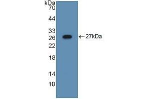 Western blot analysis of recombinant Mouse ASGR1. (Asialoglycoprotein Receptor 1 antibody  (AA 80-281))