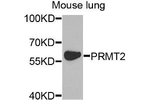 Western blot analysis of extracts of mouse lung, using PRMT2 antibody. (PRMT2 antibody)